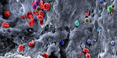 image of blood clot