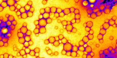 Imaging nanoparticles
